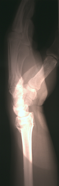 pre-reduction-side